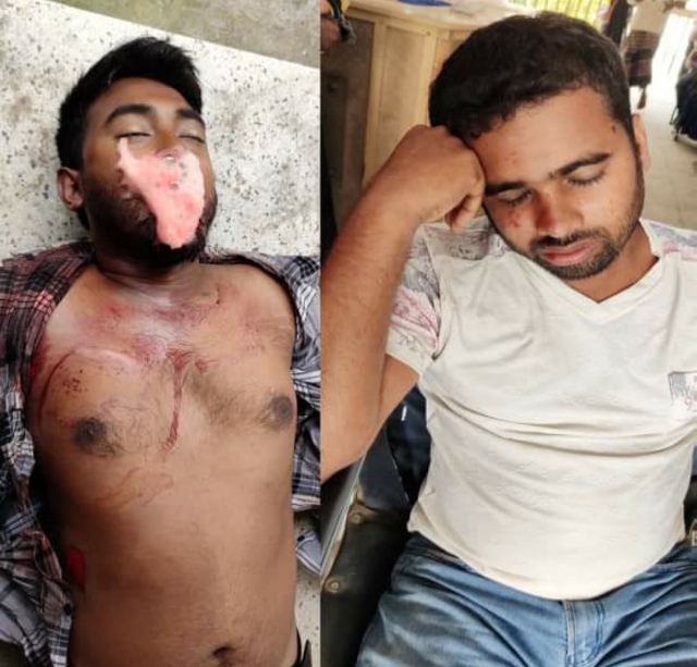 চৌগাছায় সড়ক দূঘর্টনায় নিহত এক ও আহত ৪