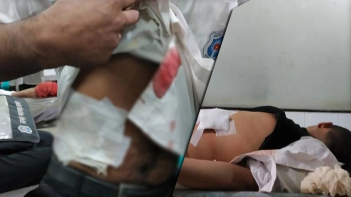 সিটি কলেজের শিক্ষার্থীদের ছুরির আঘাতে ঢাকা কলেজের ৫ শিক্ষার্থী আহত 