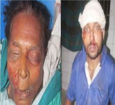 যশোরে ধনীর মাদকাসক্ত ছেলের গাড়ির চাপায় প্রাণ গেল এক জনের,আহত হয়ে মৃত্যুর সাথে পাঞ্জা লড়ছেন ৪ জন